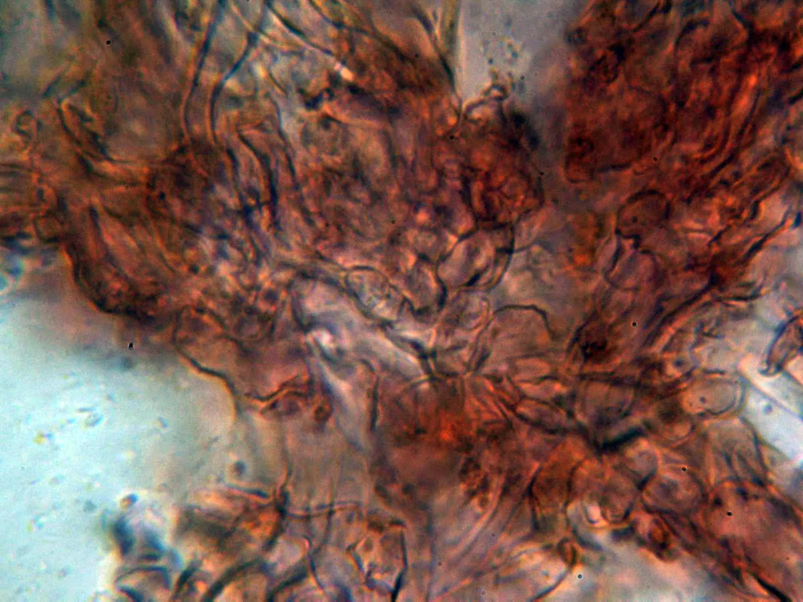 Microscopía de Octospora musci-muralis - 14 - Excípulo medular